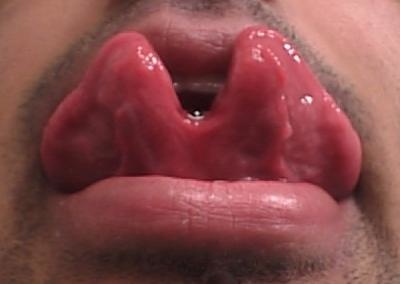 Click image for larger version

Name:	7 tongue splitting.jpg
Views:	738
Size:	24.6 KB
ID:	246129