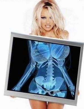 Click image for larger version

Name:	pamela-anderson-xray-boobs.JPG
Views:	160
Size:	53.6 KB
ID:	247051