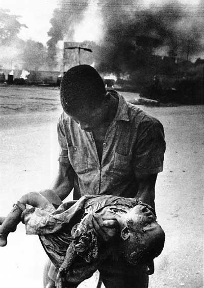 Click image for larger version

Name:	bnw-carlisle-umunna-nigeria-biafra-war-child-casualty-3.jpg
Views:	297
Size:	56.9 KB
ID:	247757